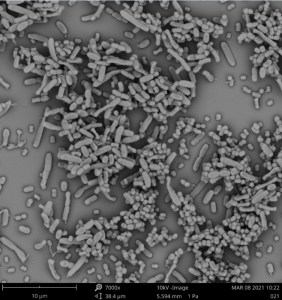 Escaneo EM de Klebsiella pneumoniae y Acinetobacter baumannii creciendo juntos